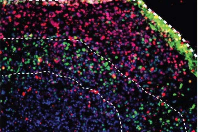 Scientists Grow Mini Brains From Patient Skin Cells | IFLScience